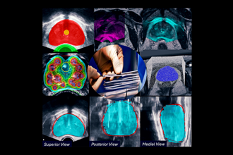 Cover art of the math onco newsletter issue 319